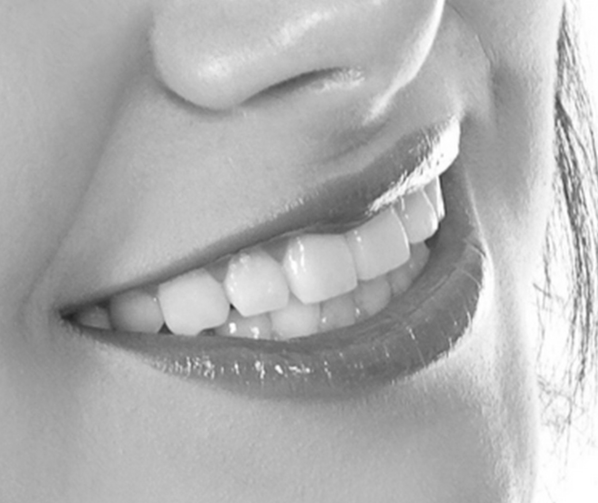 A smiling patient